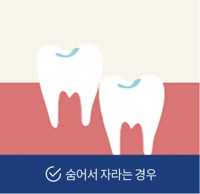 기분좋은치과의원 진료 안내 이미지